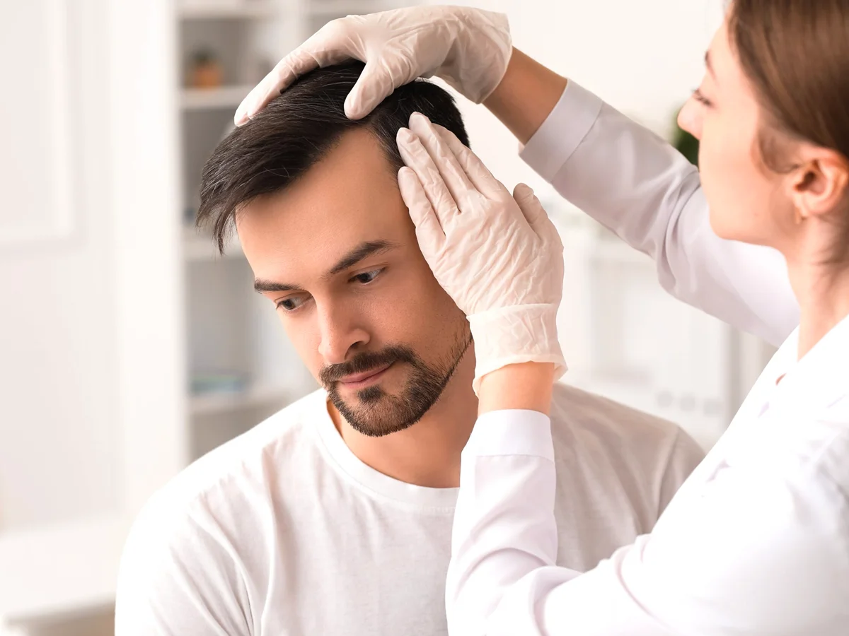 Hair Transplant London for Receding Hairlines and Bald Spots