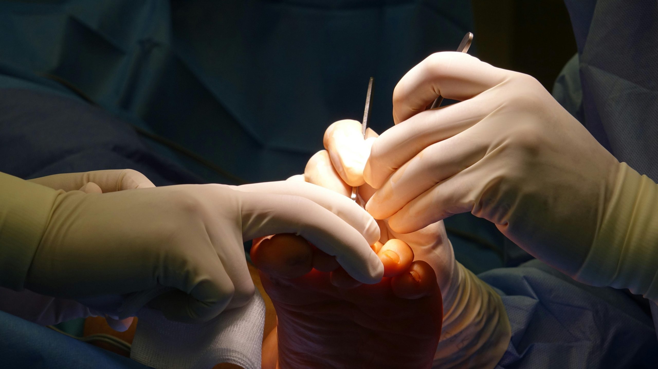 LASIK Istanbul Recovery Time and Expectations